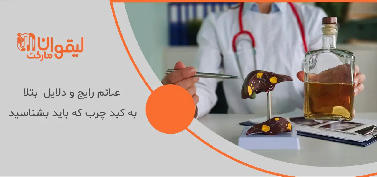 علائم رایج و دلایل ابتلا به کبد چرب که باید بشناسید